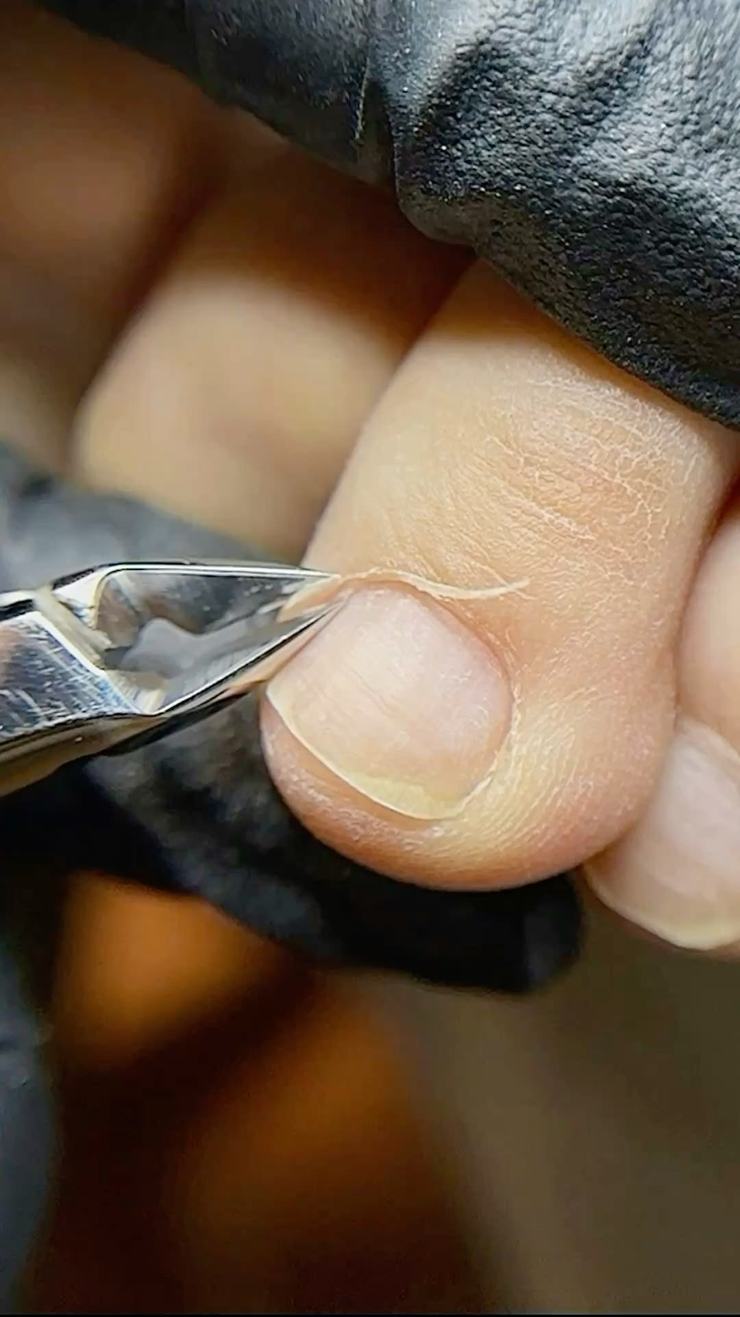Pedicure Técnica