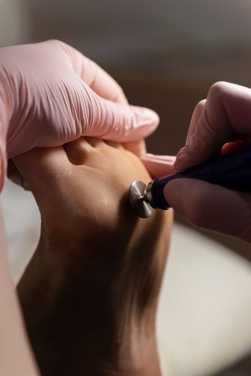Pedicure Medical